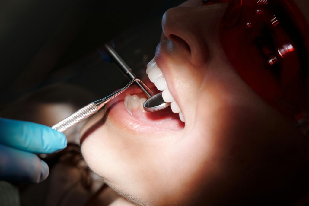 Root Canal